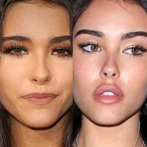 madison beer before plastic|Madison Beer Has Addressed Plastic Surgery Rumors。